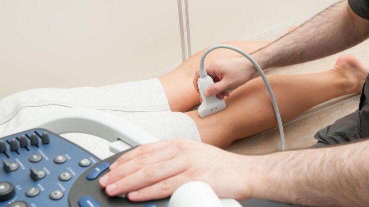 Varicose Veins: Finding Relief From the Summer Heat