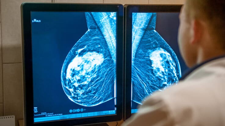 Your Mammogram